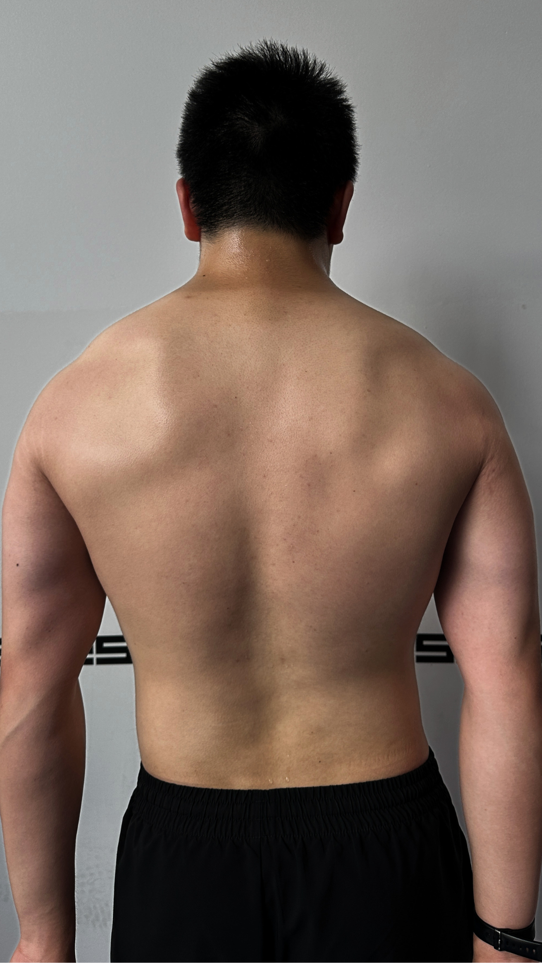 Anton transformation